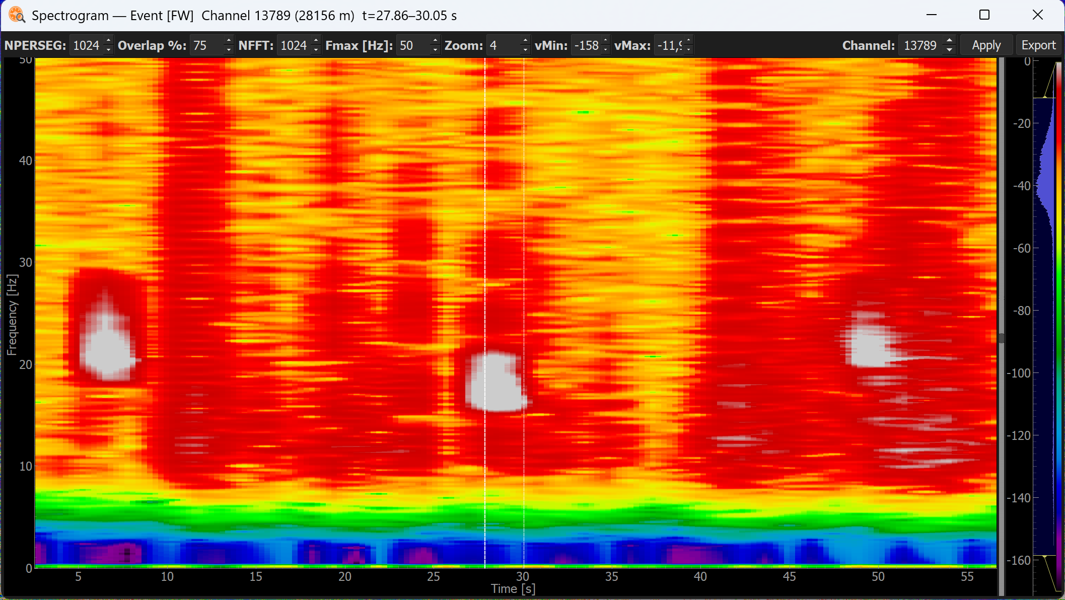 Spectrogram view